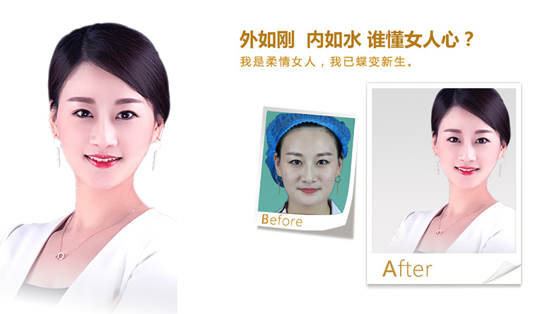 扬中V脸、线雕隆鼻